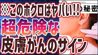 【ベストセラー】「こんなほくろに要注意！！超意外な皮膚がんの特徴5選」を世界一わかりやすく要約してみた【本要約】【本要約チャンネル※毎日19時更新】